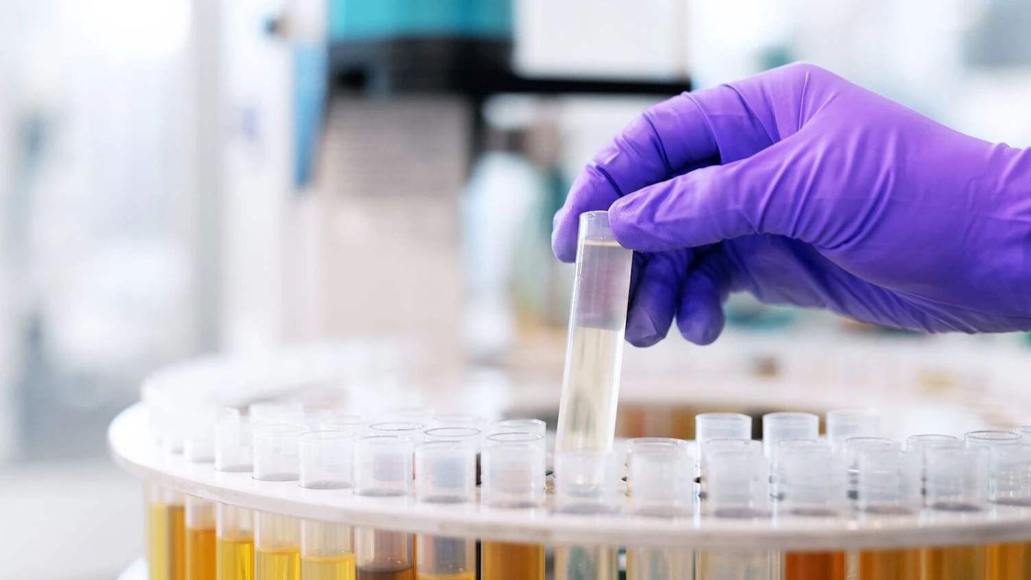 Oil Condition Monitoring