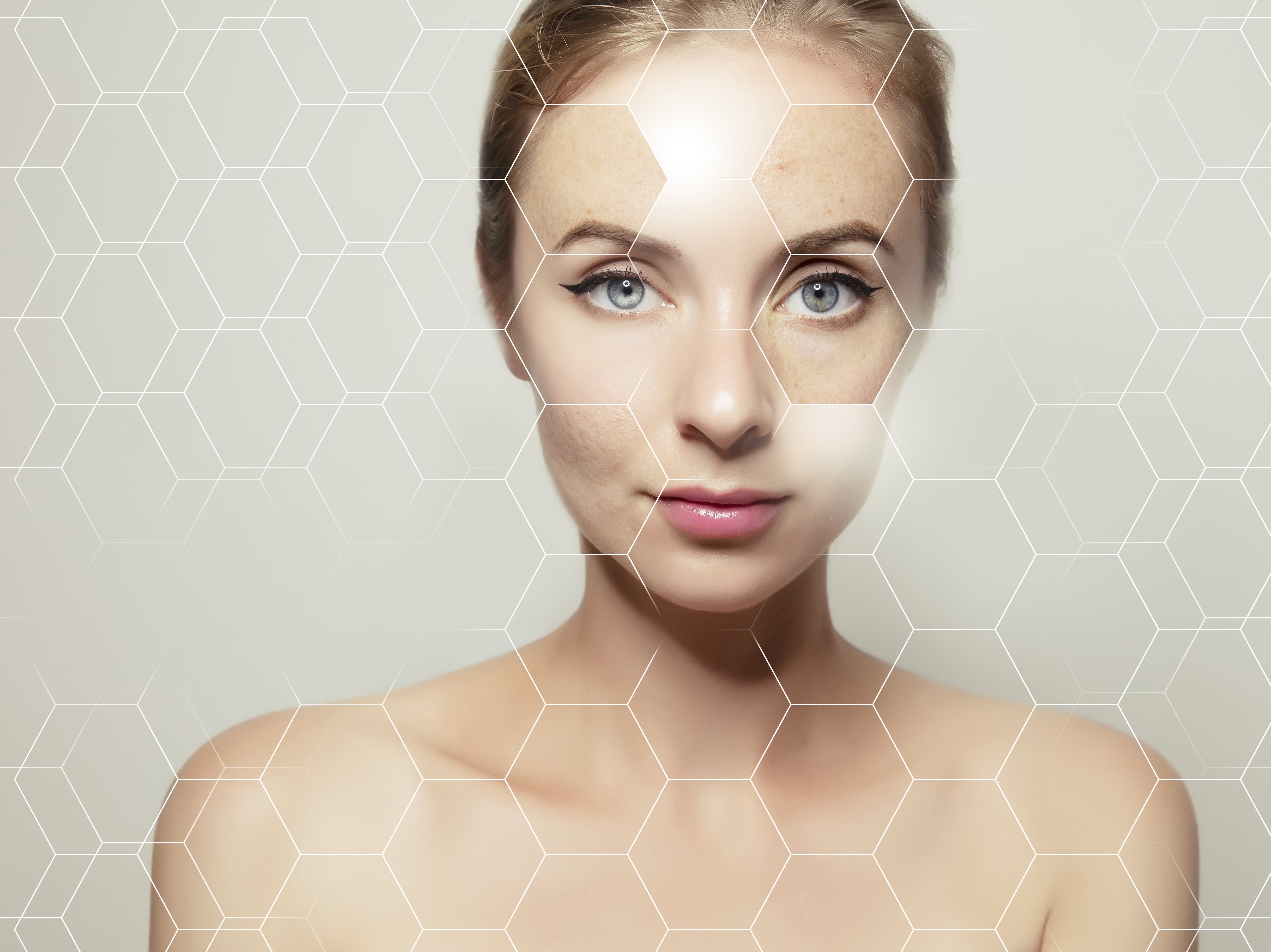 Woman Face Portrait with Clear and Pimpled Skin