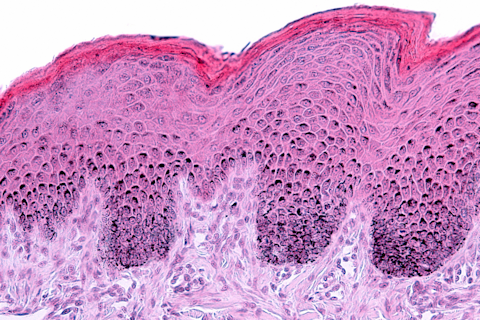 3D Reconstructed Skin Models