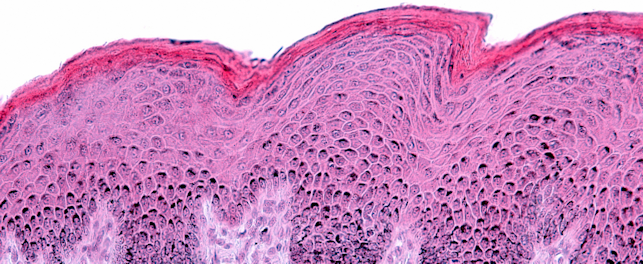 3D Reconstructed Skin Models