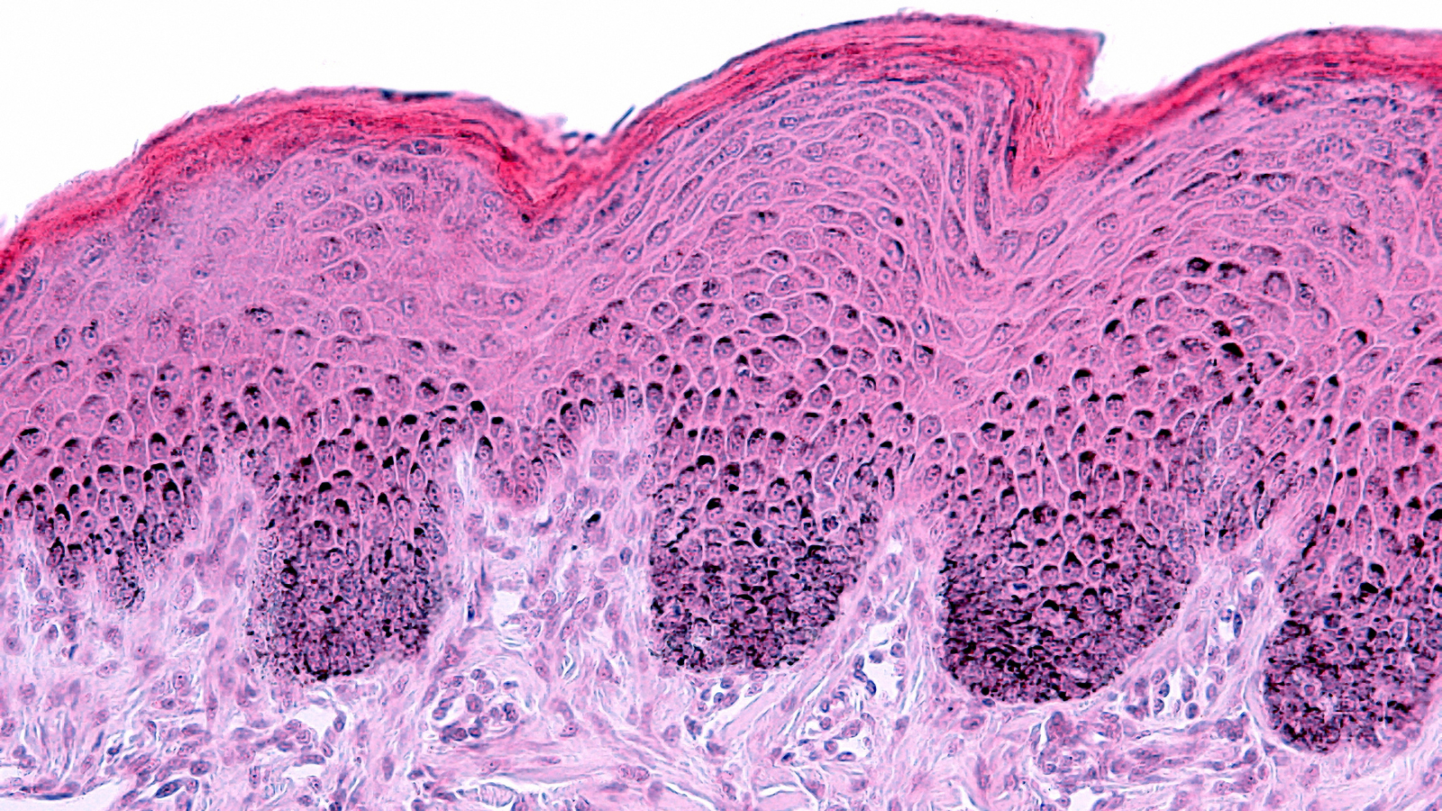 3D Reconstructed Skin Models