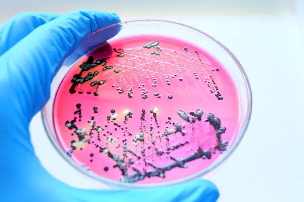 Primer plano de colonias negras de bacterias Salmonella