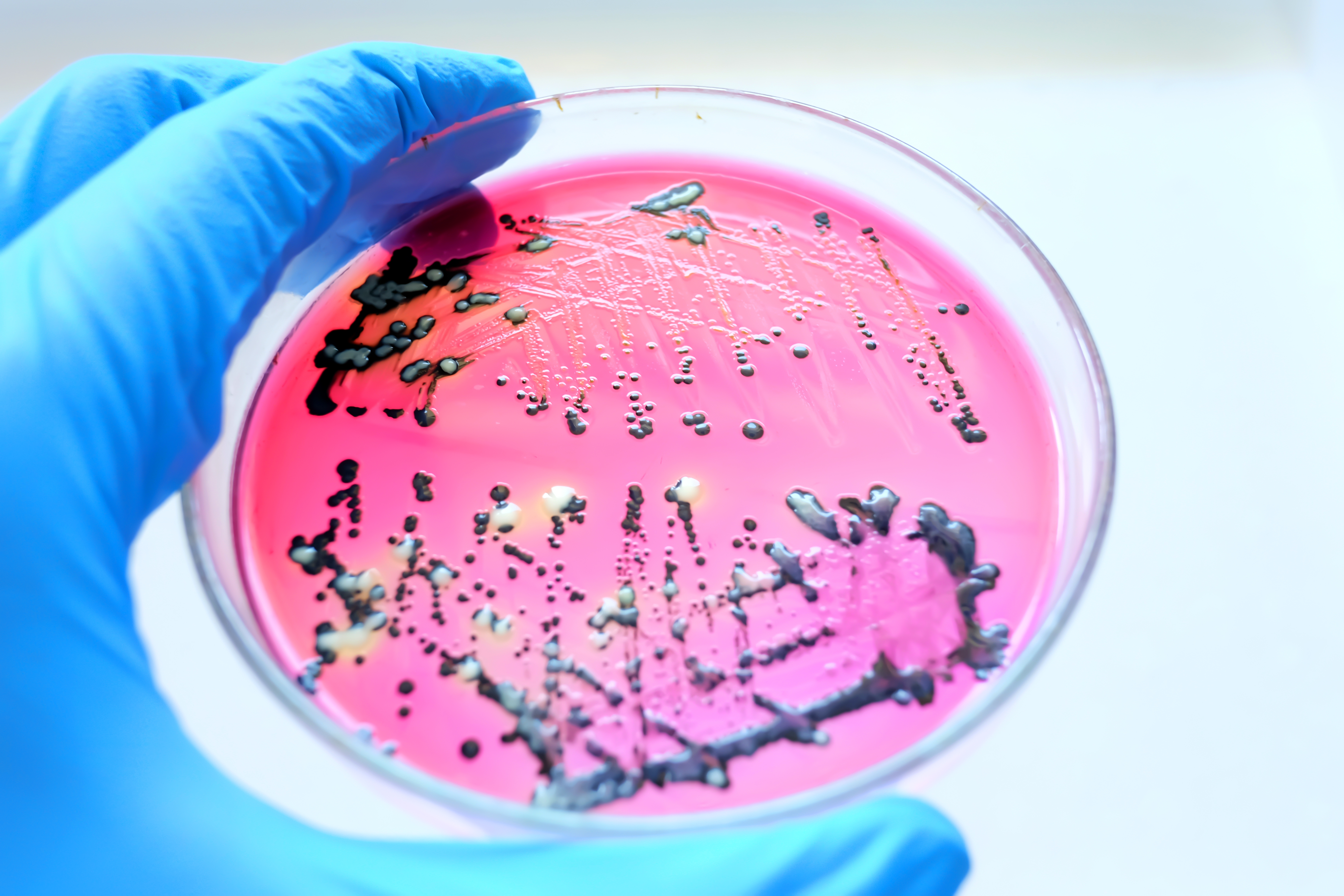 Close Up Black Colonies of Salmonella Bacteria