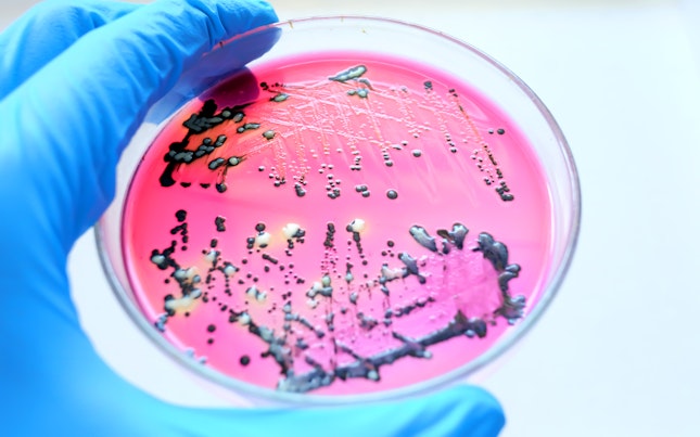 Prim plan cu coloniile negre de bacterii Salmonella