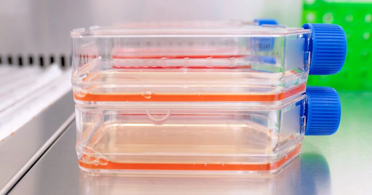 Methods Lab Report Example Viral Vaccines | SGS Canada