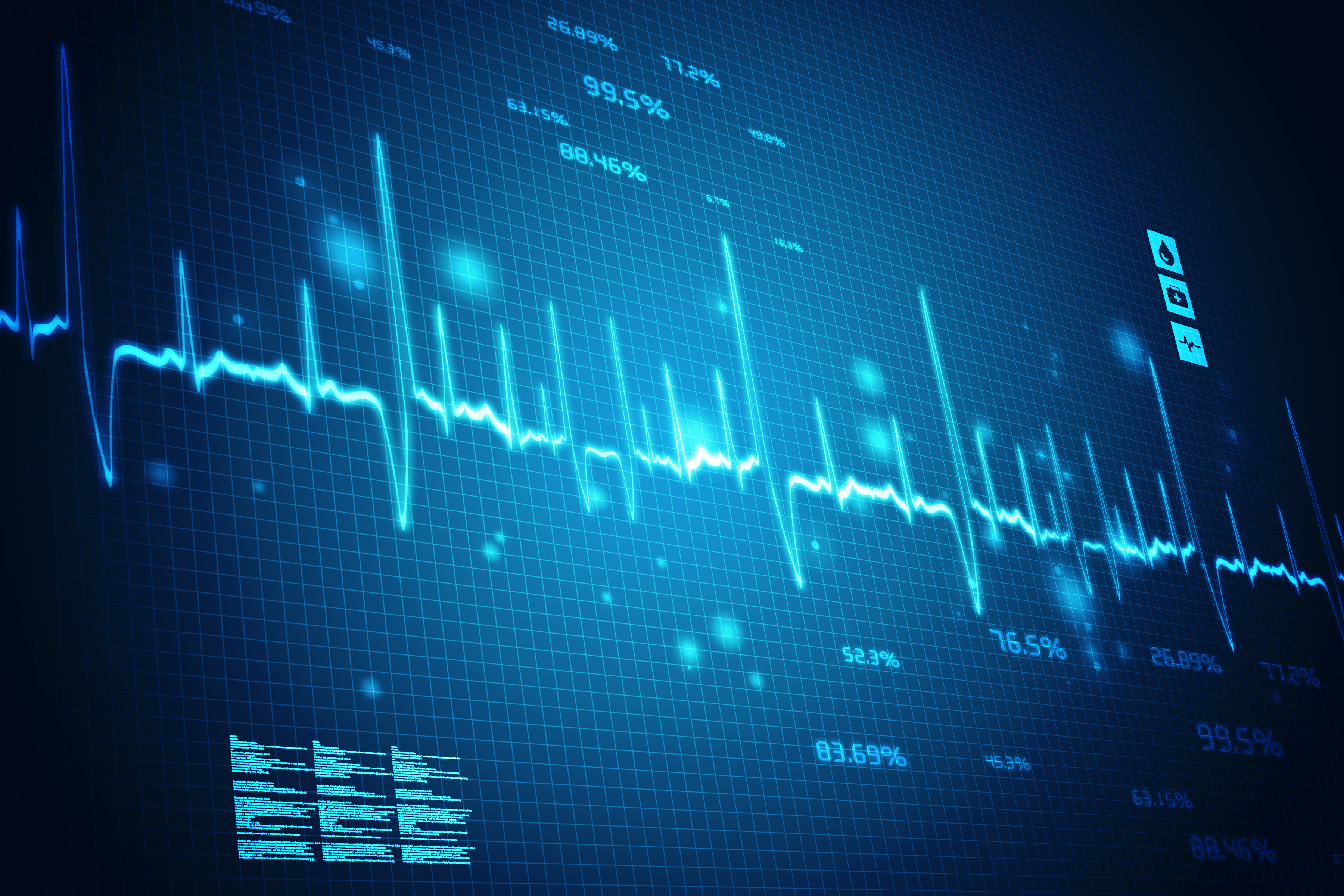 Glowing forex chart