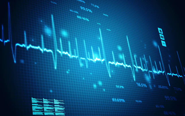Glowing forex chart