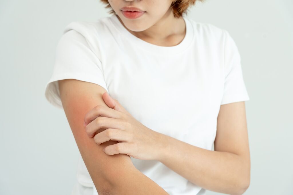 Itchy skin from skin allergy