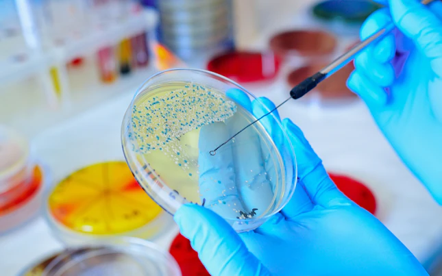 Microbios en una placa de vidrio de prueba