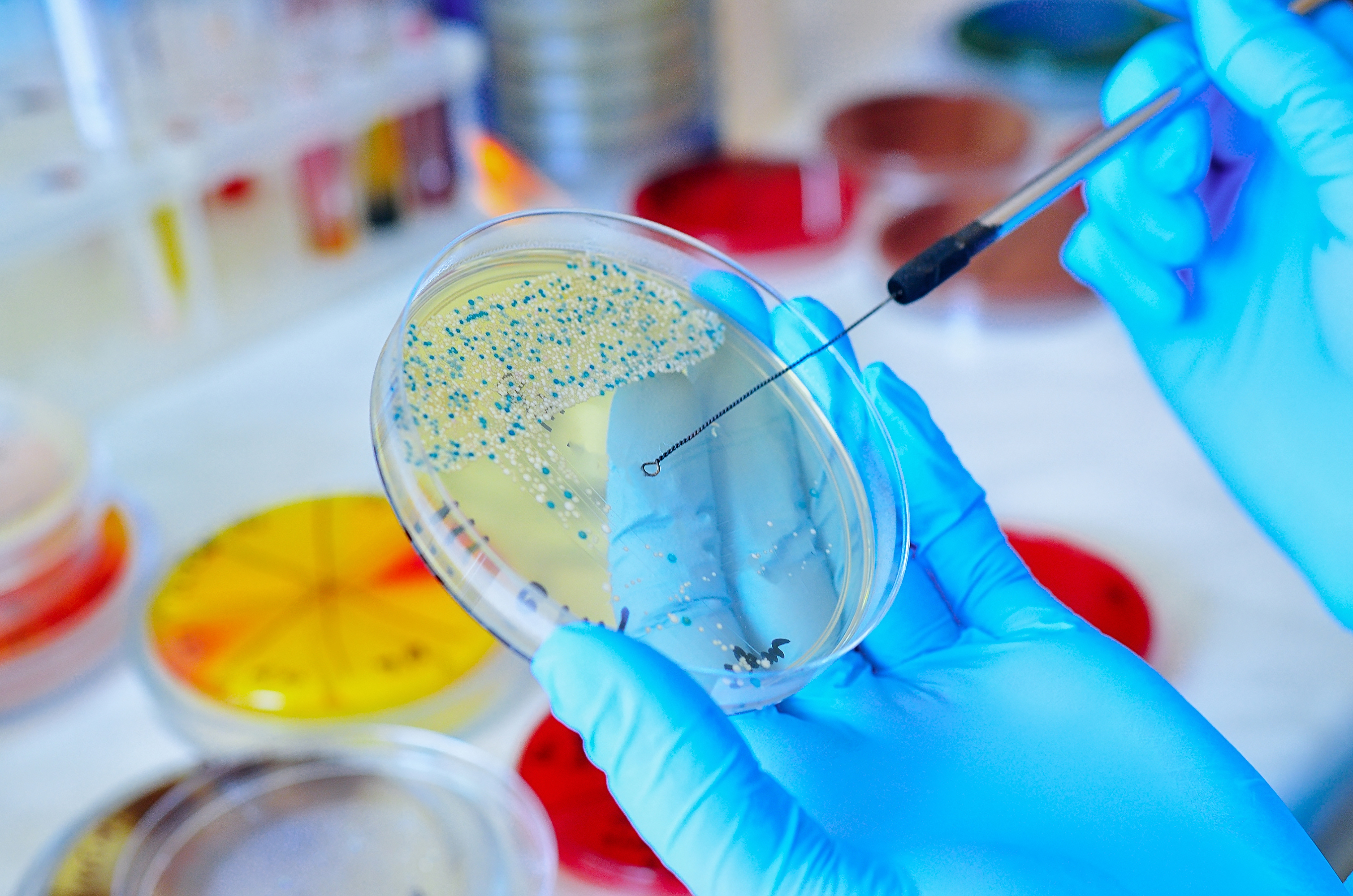 Microbes in a testing glass plate