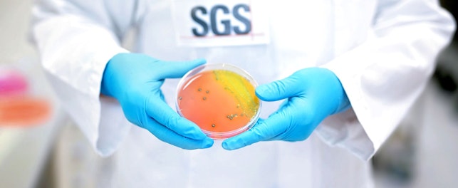 SGS Microbiology Services Lab Scientist Holding Specimen