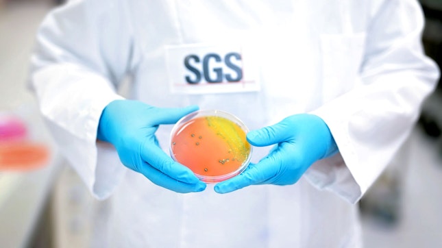 SGS Microbiology Services Lab Scientist Holding Specimen