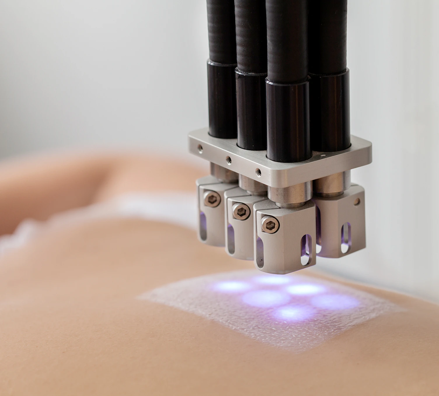 Suncream Allergy Skin Test