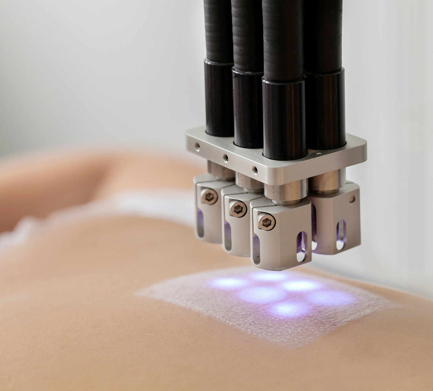 Suncream Allergy Skin Test