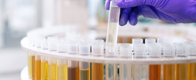 Machinery Oil Wear Analysis or Engine Lubricant Testing, Industrial Lubricant Testing.