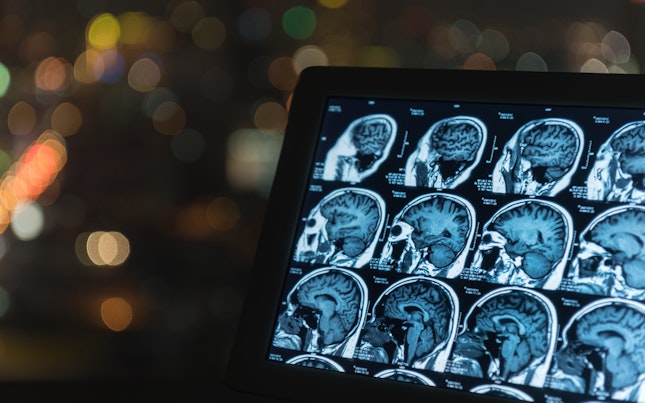 MRT-Scan des Gehirns auf einem Tablet-Computer