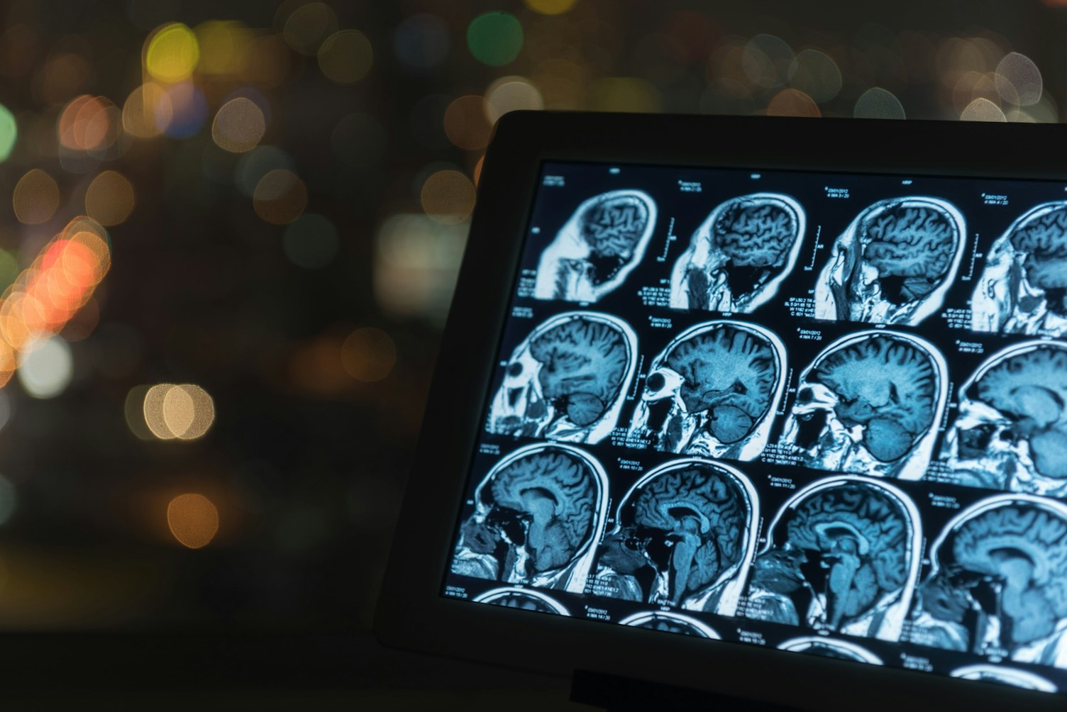 MRI Scan of the Brain on Tablet Screen Computer
