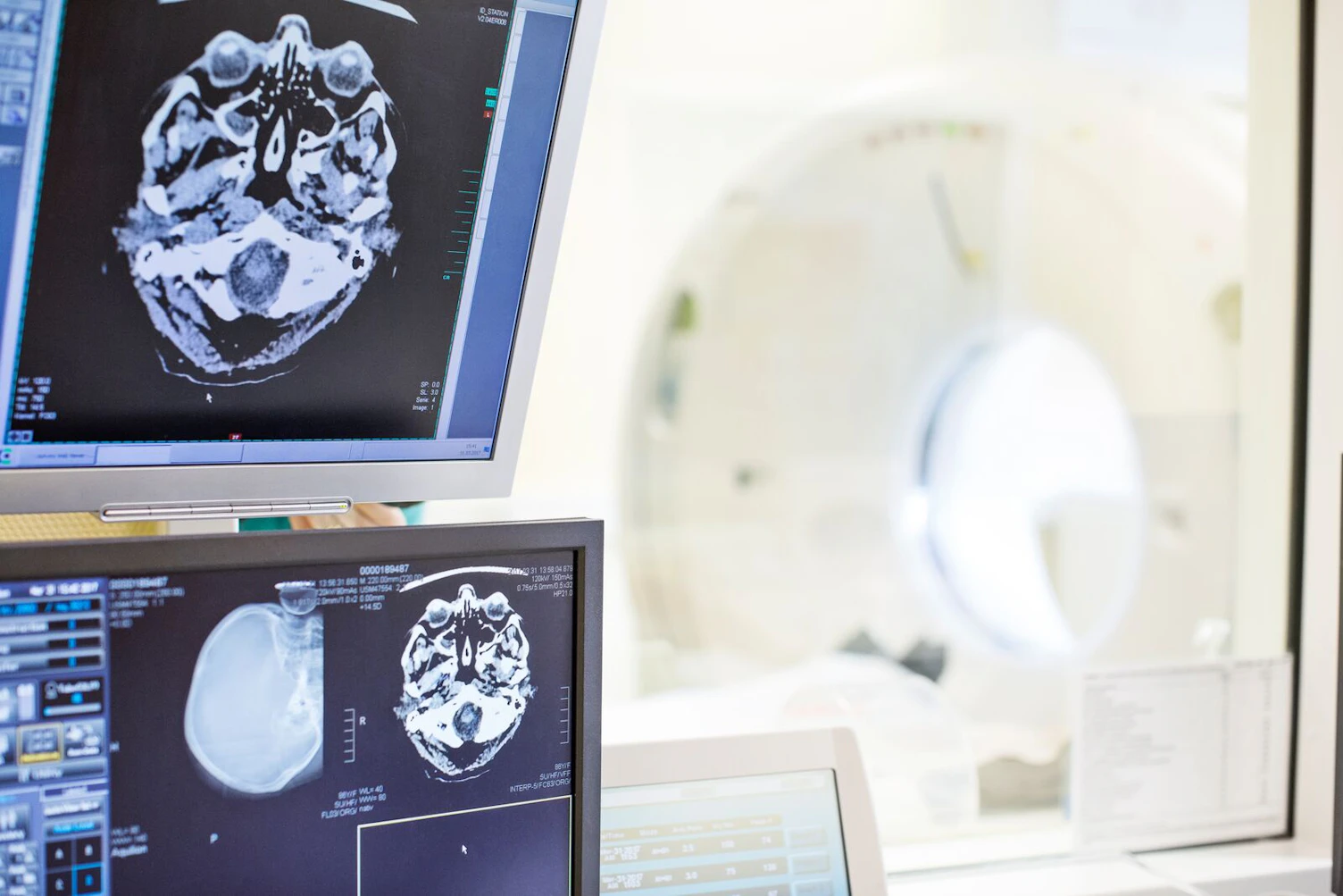X-Ray Images on CAT Scanner Screen