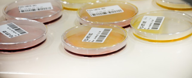 Muestras laboratorio HN puerto varas chile