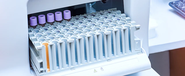 Medical Automatic Urine and Blood Analyzer