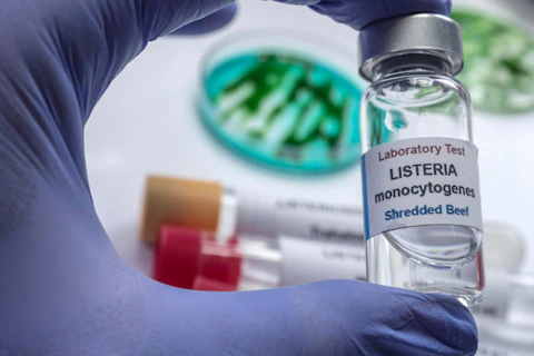 Listeria monocytogenes sgs