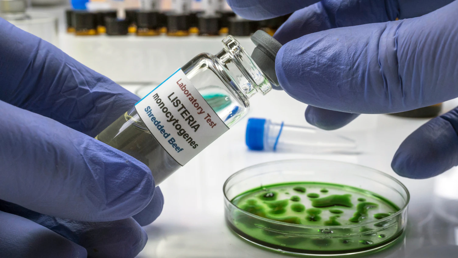 Listeria monocytogenes sgs