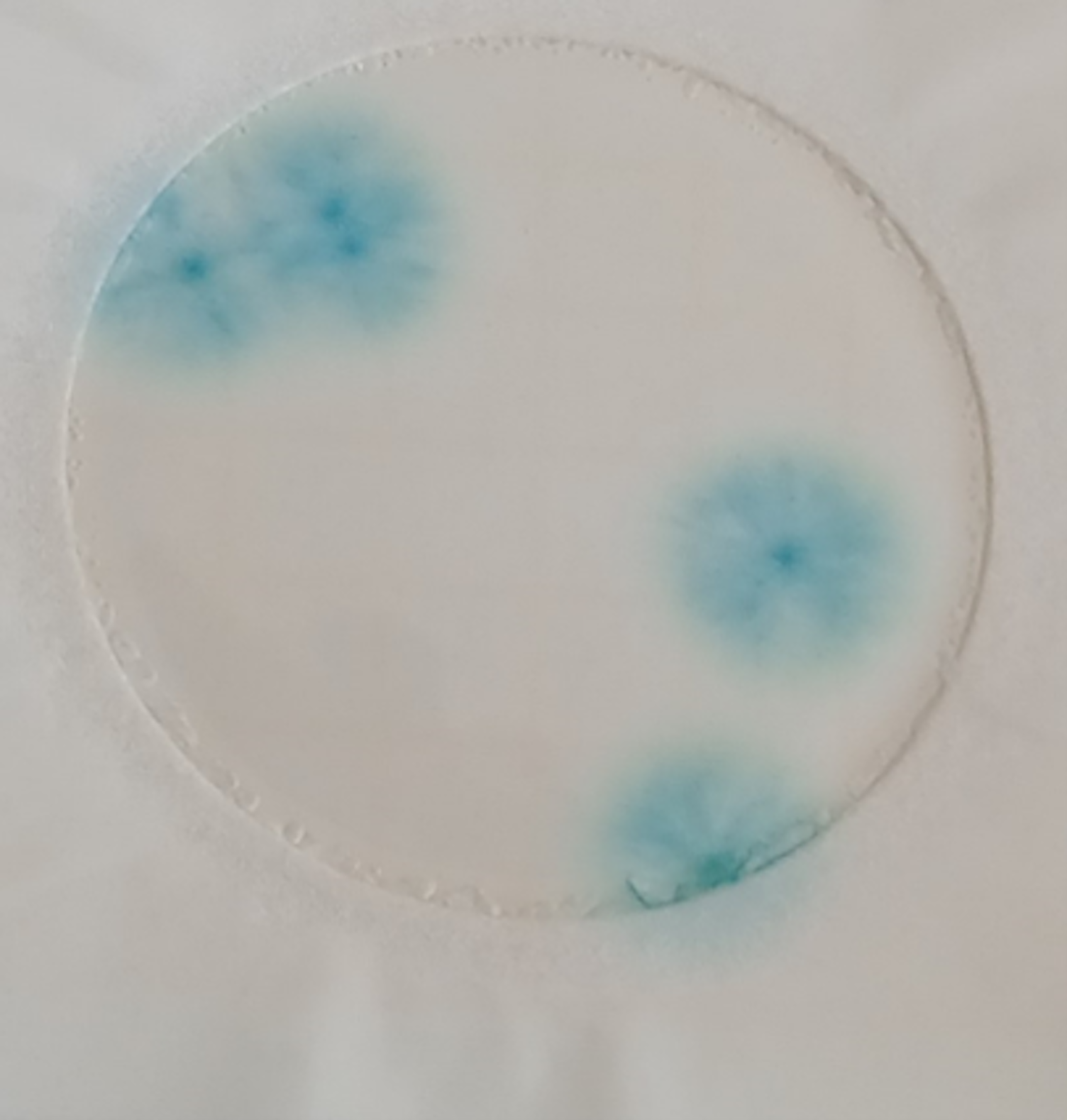 Zdjęcie przedstawia kolonie pleśni wykryte z pomocą Petrifilm.