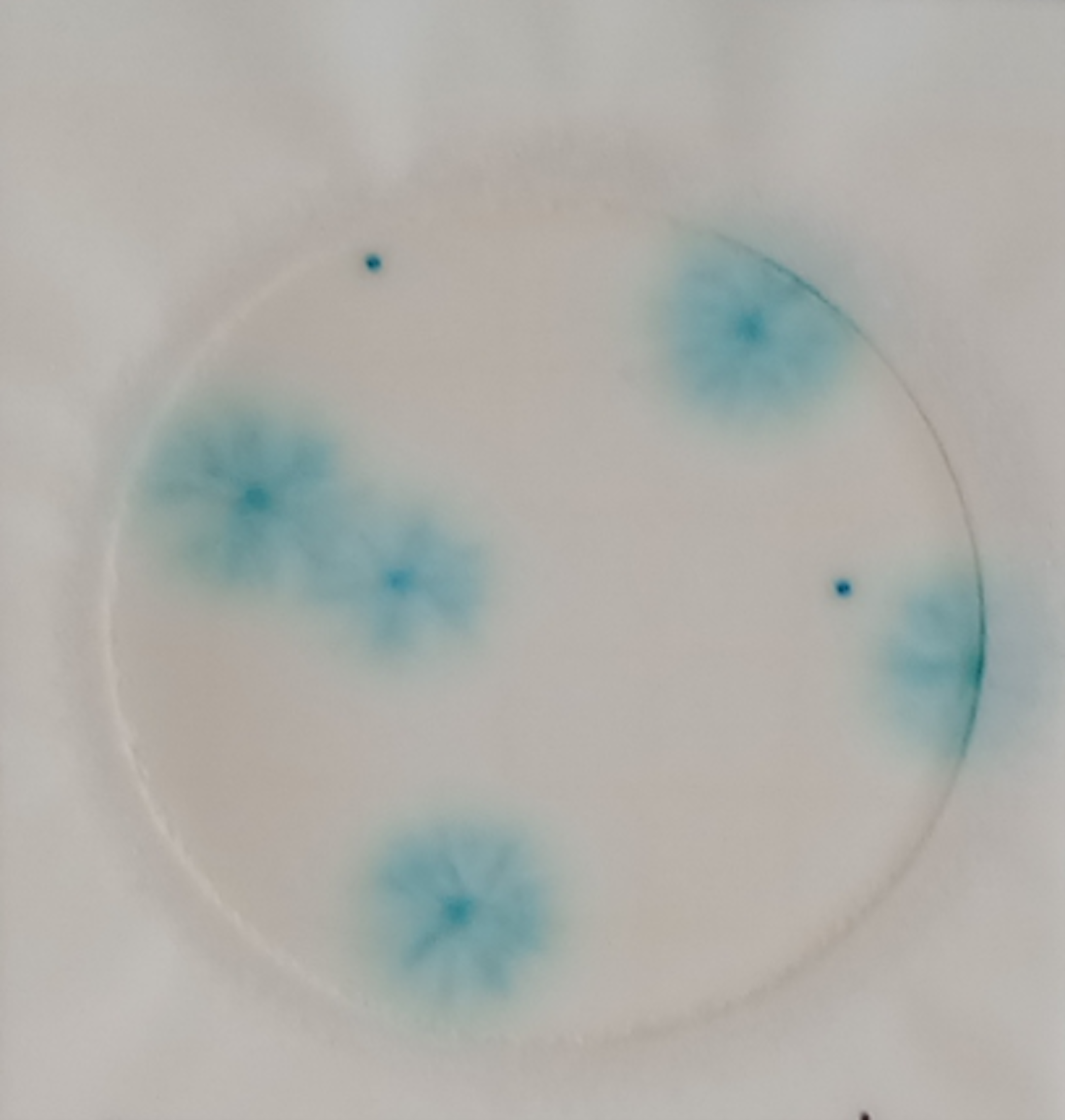 Zdjęcie przedstawia kolonie drożdży i pleśni wykryte z pomocą Petrifilm.
