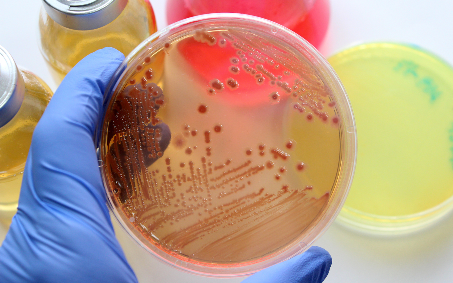 Standardy i certyfikacja podłoży mikrobiologicznych mają wpływ na jakość wyników badań.