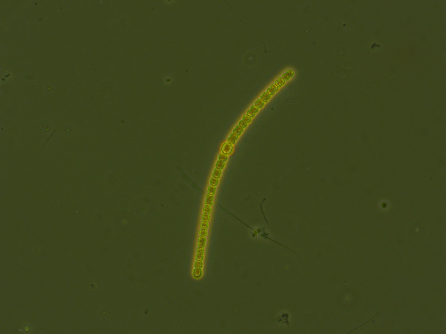 Anabaena sp