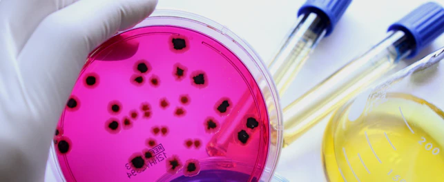 Microbes in a testing glass plate