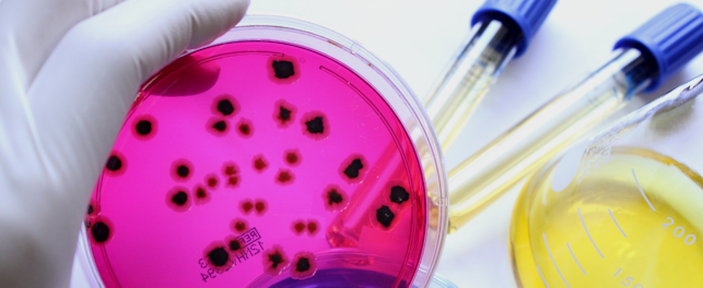 Microbes in a testing glass plate