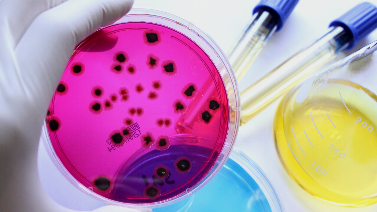 Microbes in a testing glass plate