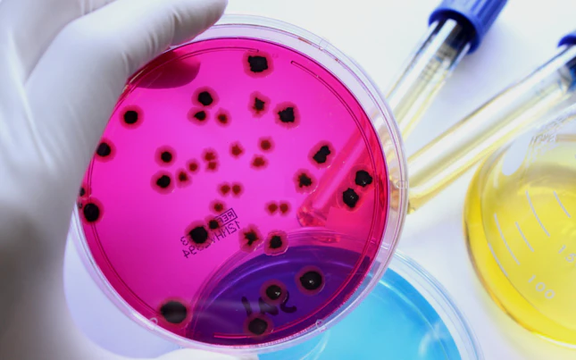 Microorganismi su una piastra di coltura per test di laboratorio