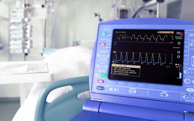 Monitor intra-aortic counterpulsation device against the ICU
