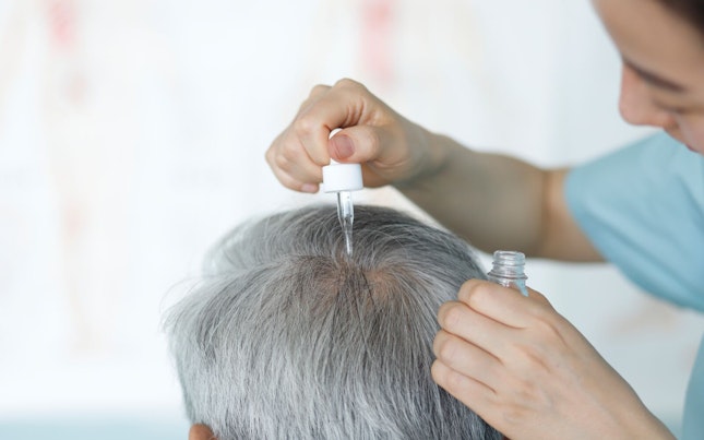 Doctor Applying Hair Serum of Man's Scalp