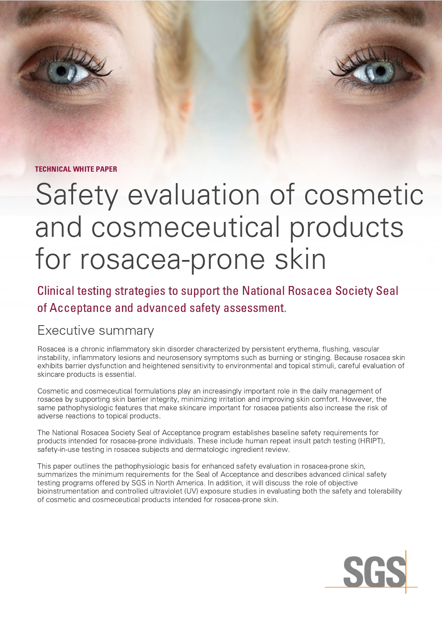 Safety Evaluation of Cosmetic and Cosmeceutical Products for Rosacea prone Skin